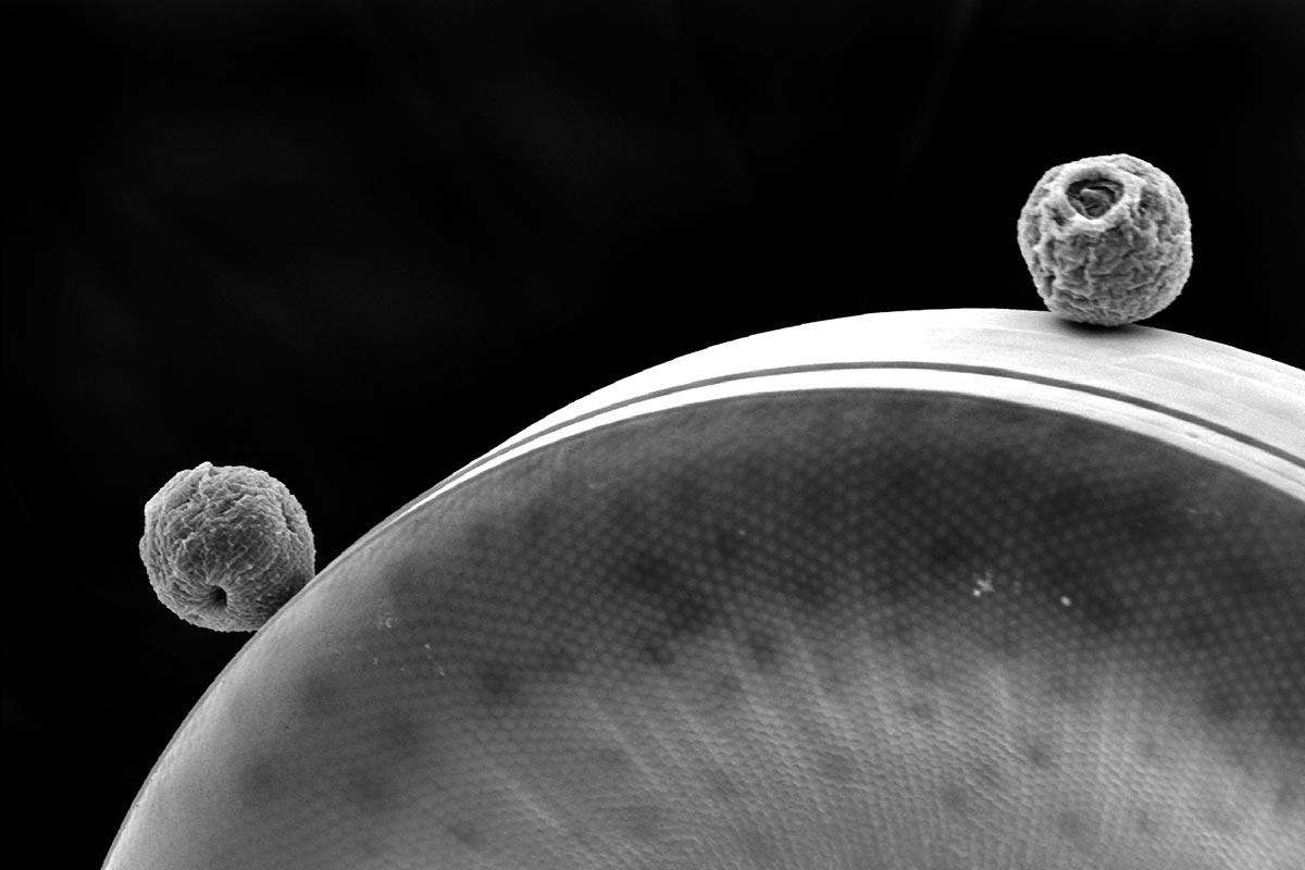 Peritrich ciliates on <i>Coscinodiscus</i> sp. diatom